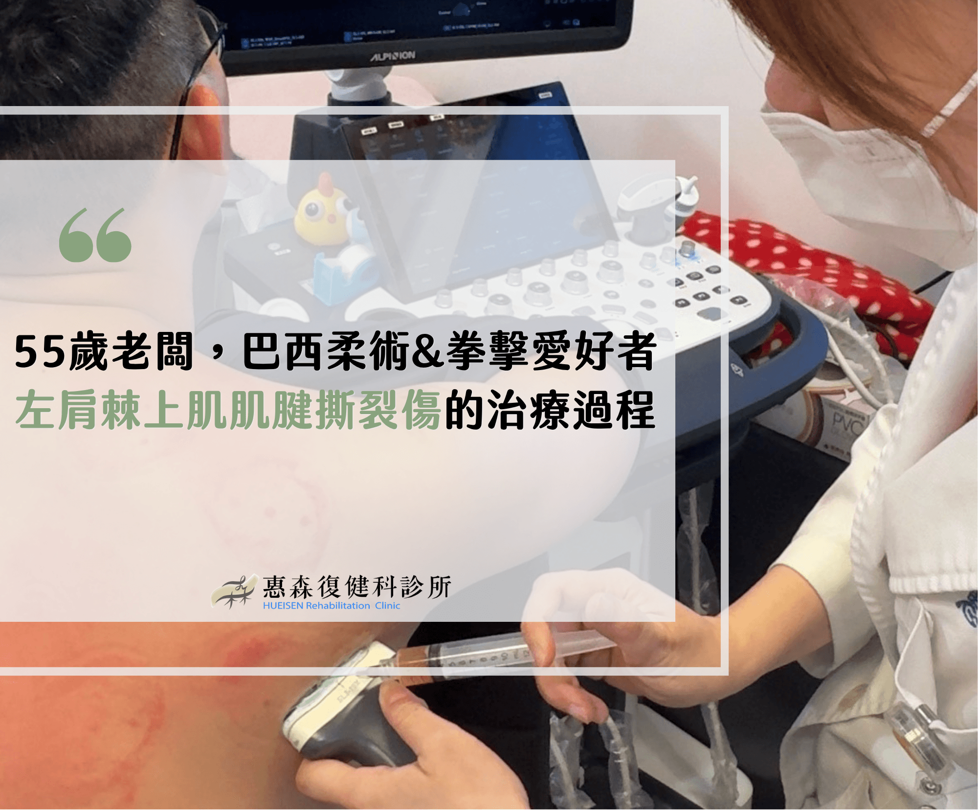 羊膜增生