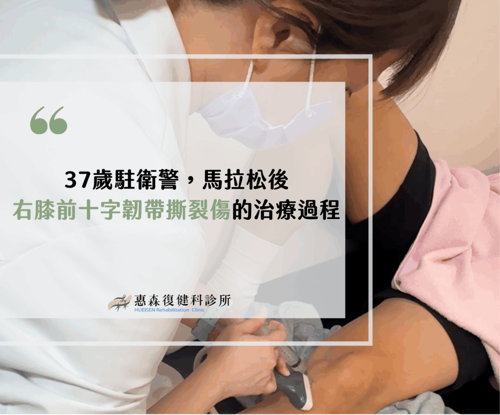 前十字韌帶撕裂